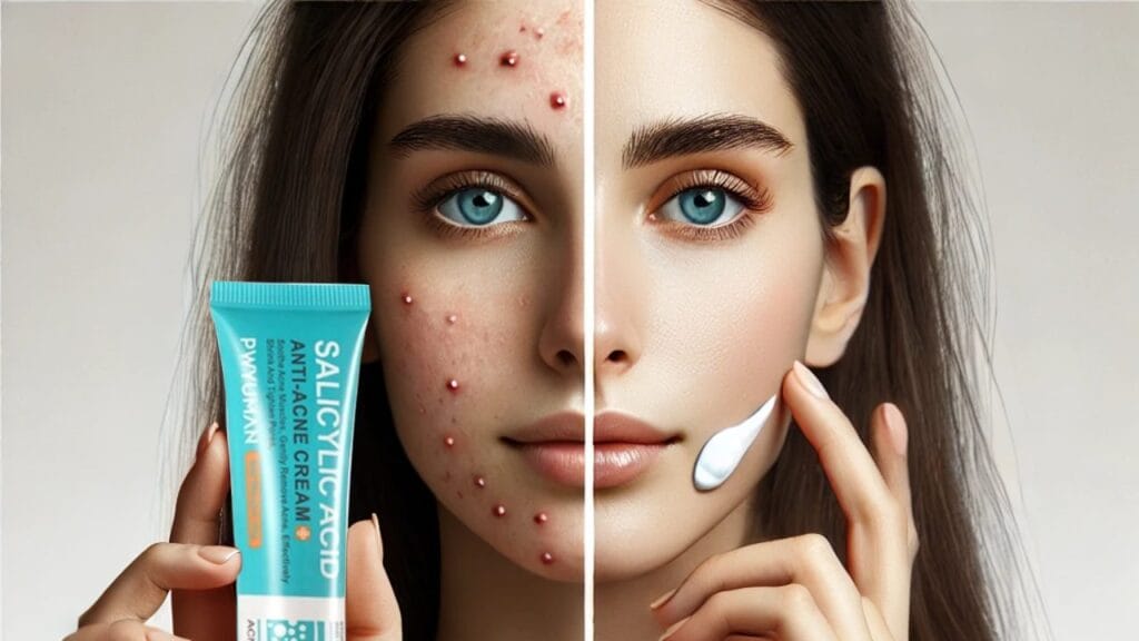 منتج كريم لازالة حب الشباب سريع المفعول مع مكوناته الفعالة