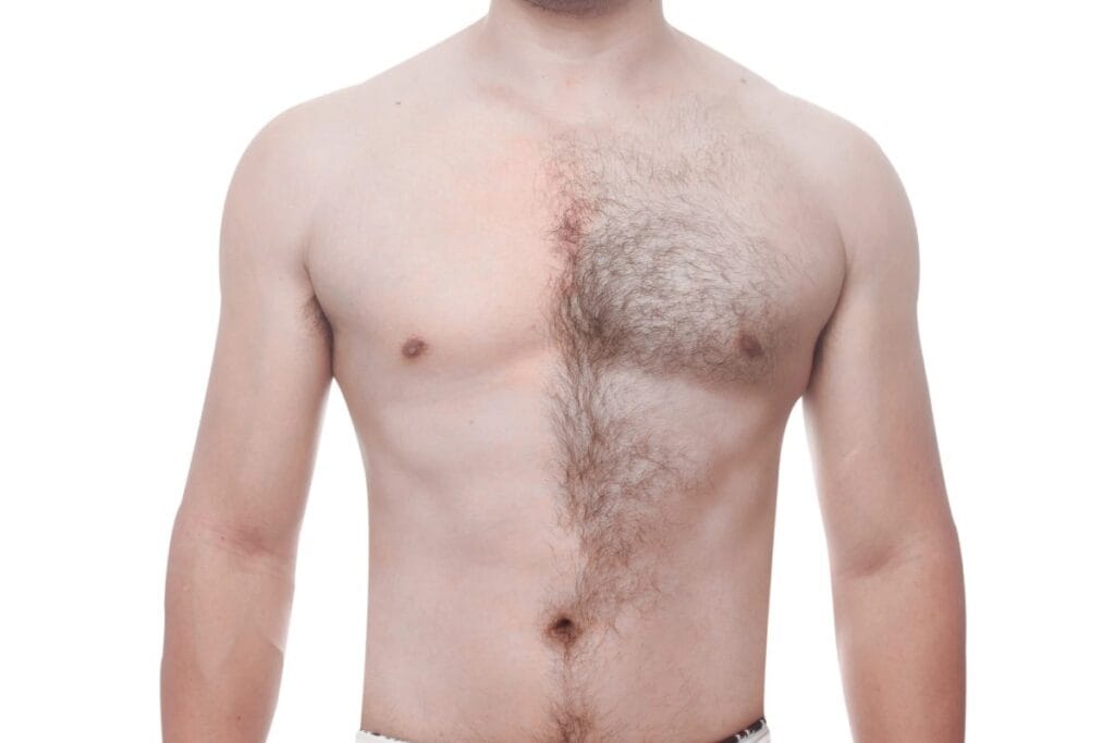 ازالة شعر الجسم للرجال
