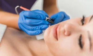 طريقة إزالة الشعر مدى الحياة